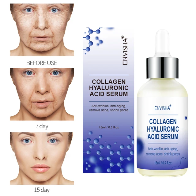 Envisha Arcbőrápolás Kollagén Hialuronsav Szérum Retinol-Vitamin Öregedésgátló Ráncok Hidratáló Fehérítő Zsugorodó Pórusok