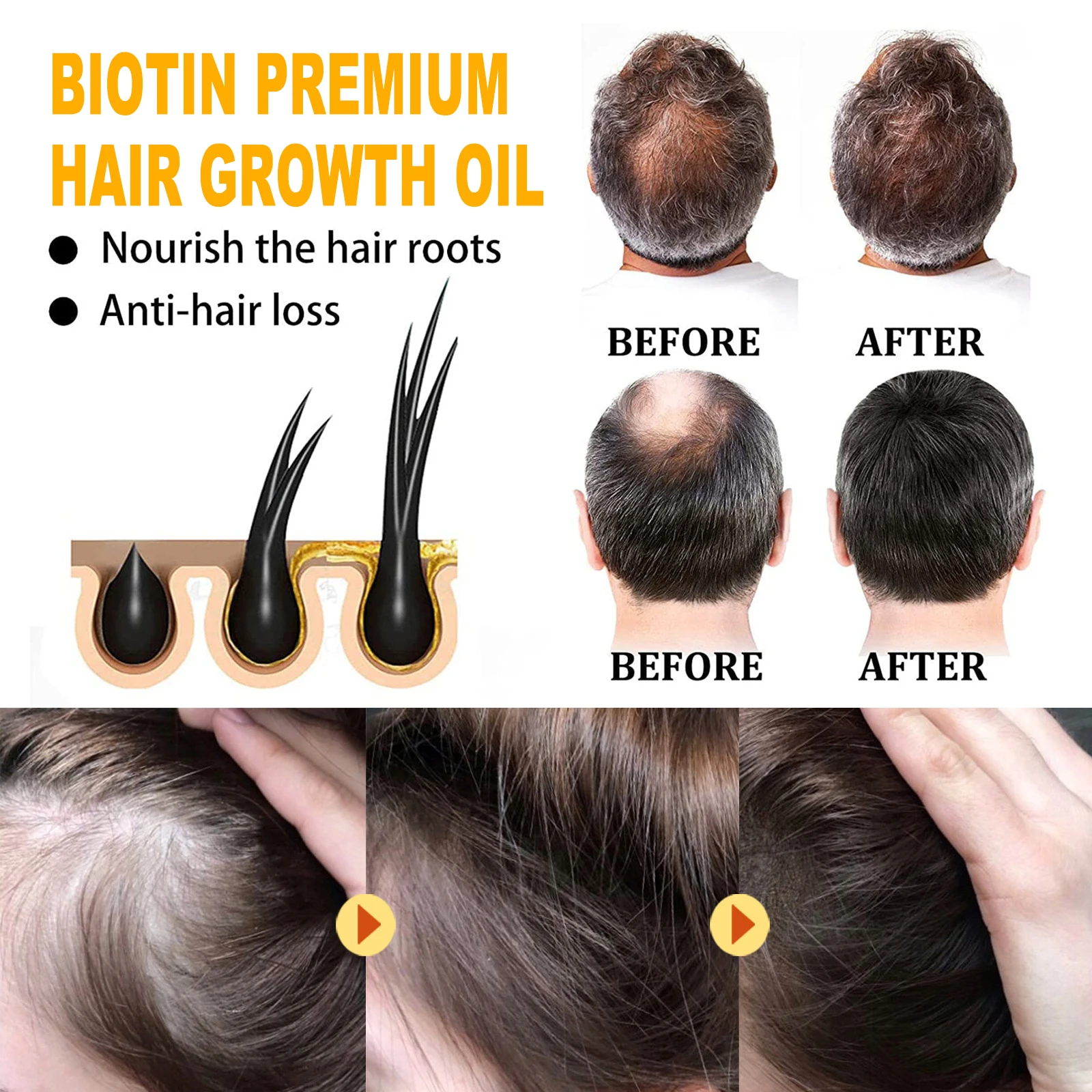 Biotin Hair Growth Spray Anti Dandruff Itching Treatment Dry Frizzy Nourish Scalp Damaged Repair Serum Hair Care Essential Oils