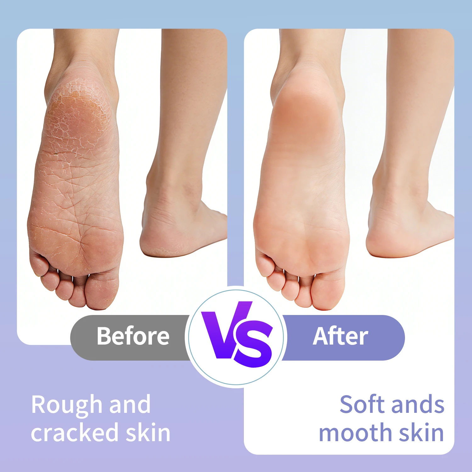 Electric Foot File Callus Remover For Smooth Feet Rechargeable_voghion.com