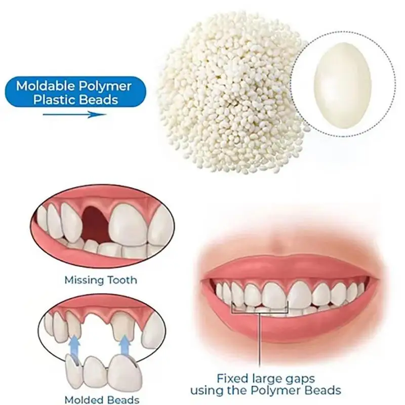 Tooth Repair Kit-Thermal Beads for Filling Fix The India