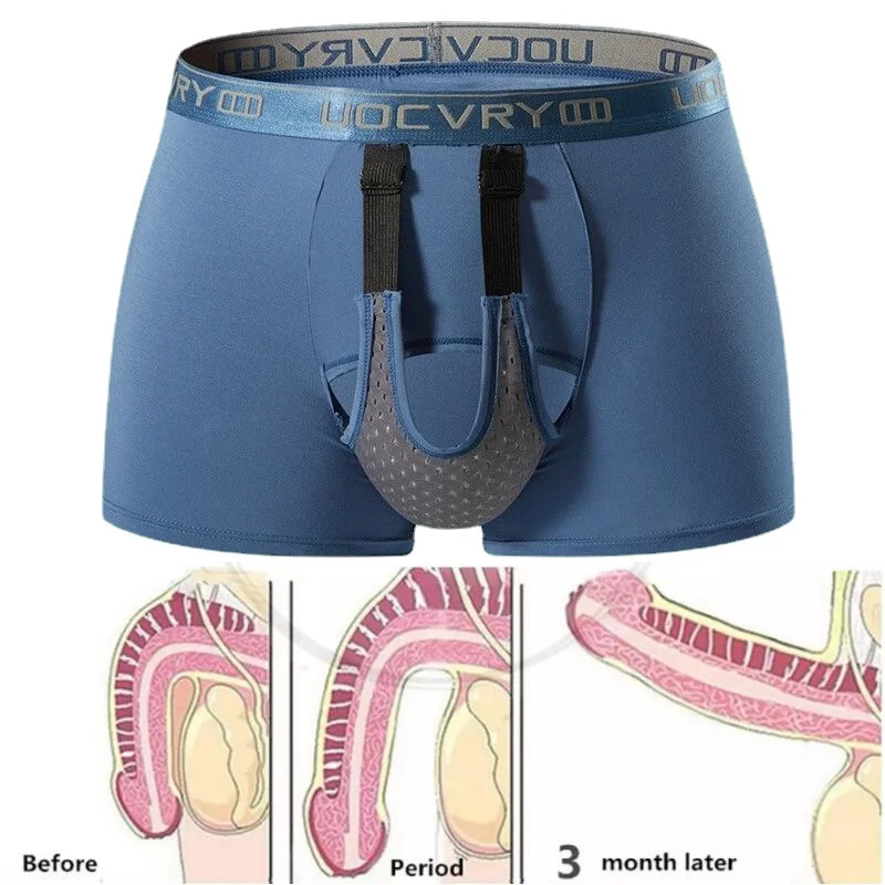 Penis Varicocele Cure Lingerie Scrotum Support Underwear Men's