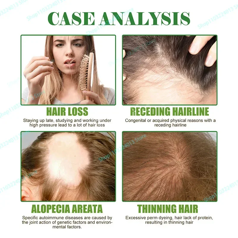 

Sdottor Hair Growth Essential Oil Rosemary Mint Hair Strengthening Oil Nourishing Treatment for Split Ends and Dry Mielle Organi