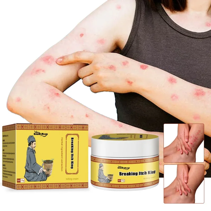 

Psoriasis Cream For Dermatitis And Eczema relieve itching Herbal Medicine Ointment Anti-Itch Antibacterial Eczematoid Skin Care