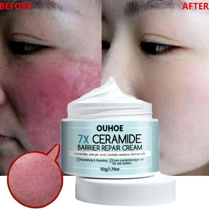 

7 Day Repair Facial Redness Cream Collagen Repair Redness Dry Sensitive Skin Moisturize Hydrating Sooth Lotion Korean Cosmetics