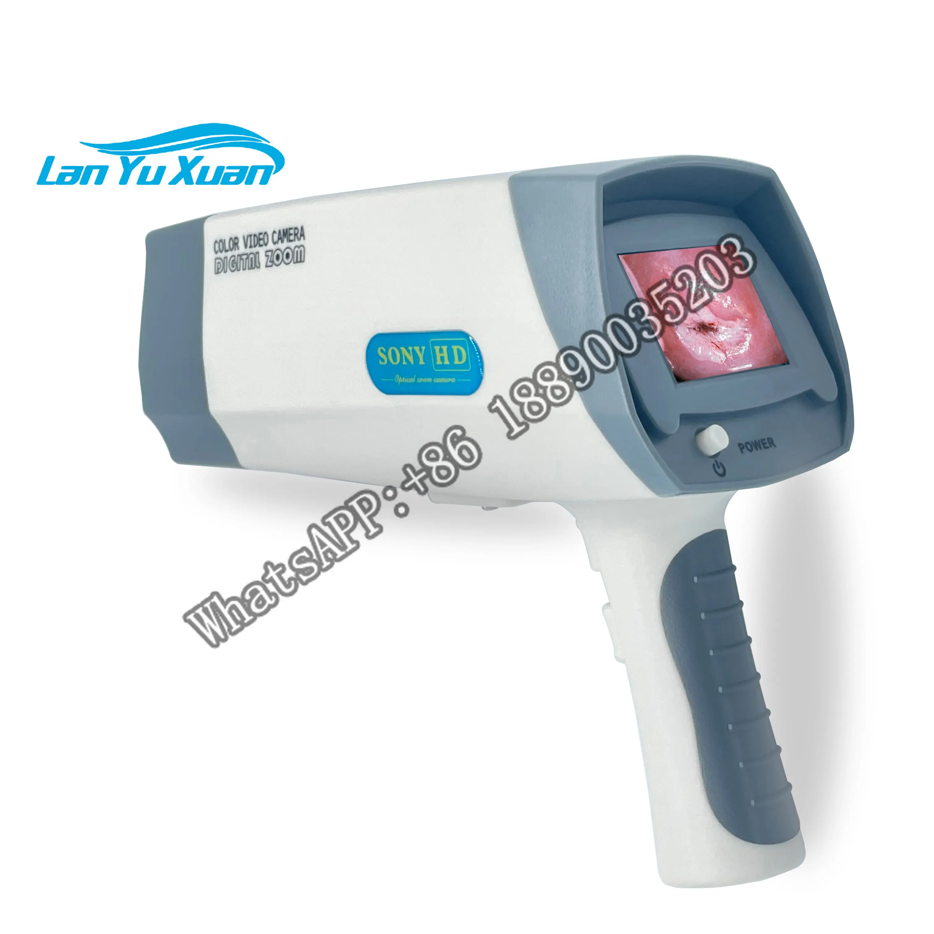 

Vaginal Self-Exam Colposcope Home Used Digital Video Portable Mini-