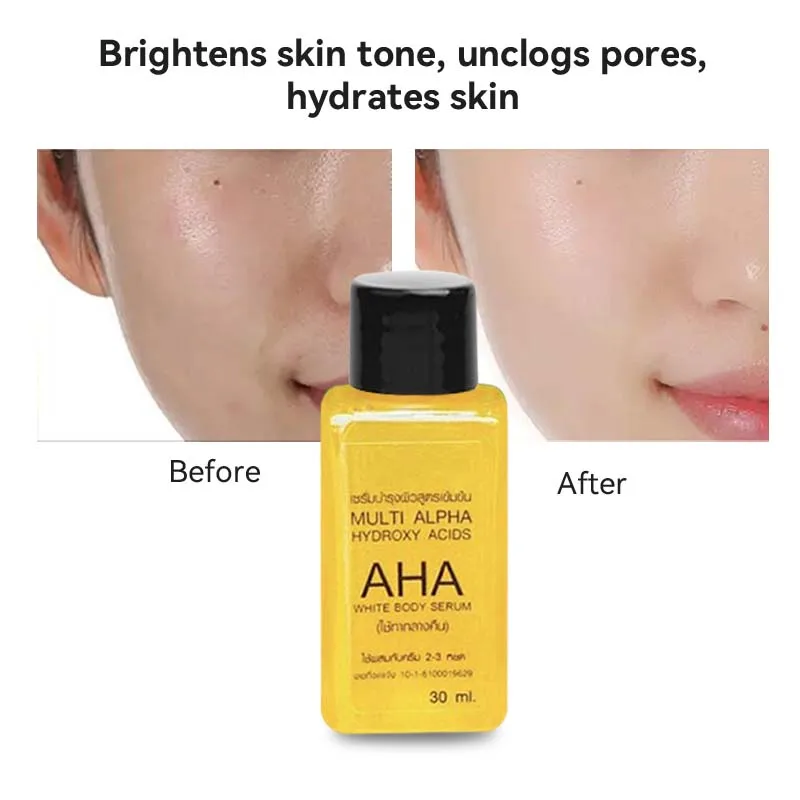 AHA Alpha Hydroxy Acid Whitening Body Serum Brightening Moisturizing Remove Melasma Dark Spot Korean Skin Care Skincare Products