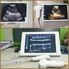 2024 New Veterinary Wired Ultrasound Scanner Portable Color Doppler 3.5/7.5Mhz Convex Probe for Horse Goat Cow Sheep and Pig 3