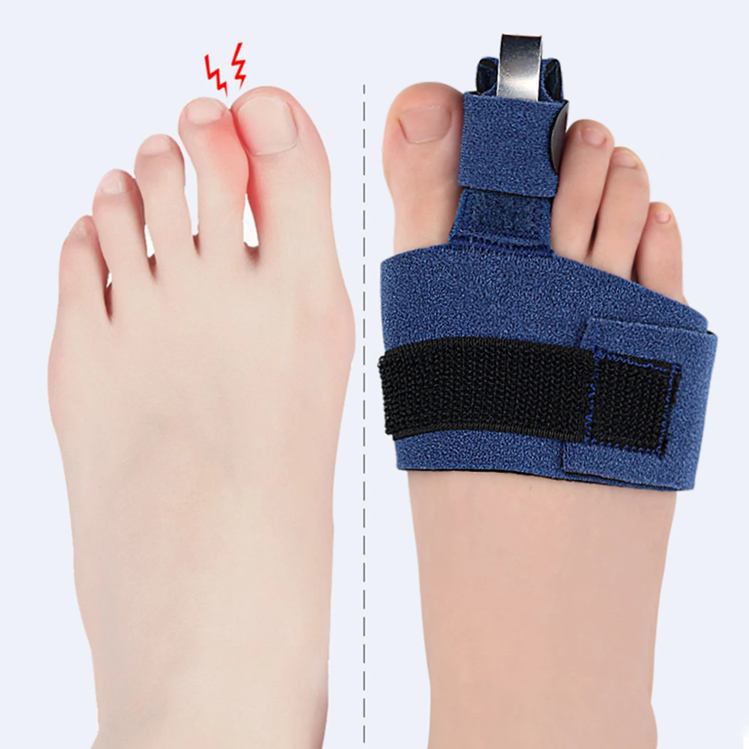 

1Pc Thumb Valgus Correction Adjuster Feet Straightener Foot Finger Toe Separator Toe Correction Tool Toe Valgus Corrector