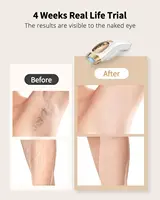 IPL Hair Removal Unlimited Flashes 9 Gears Laser Ice-Cooling Painless Electric Depilator For Men Women Body Bikinis intimate 2