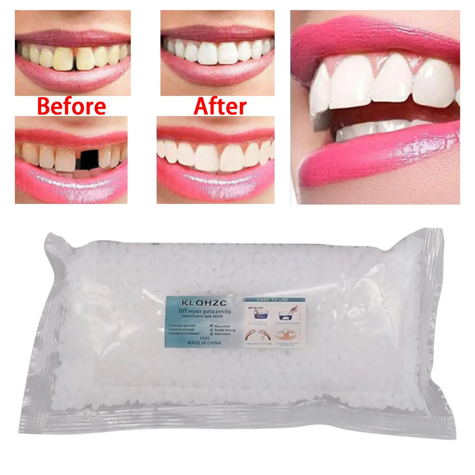 1 bag 100g Tooth Thermal Adhesive Fitting Beads Temporary Teeth Repair  Veneer Replacement Teeth Filling Thermal Beads Denture Beads for Teeth  Broken Teeth and Teeth Gaps 