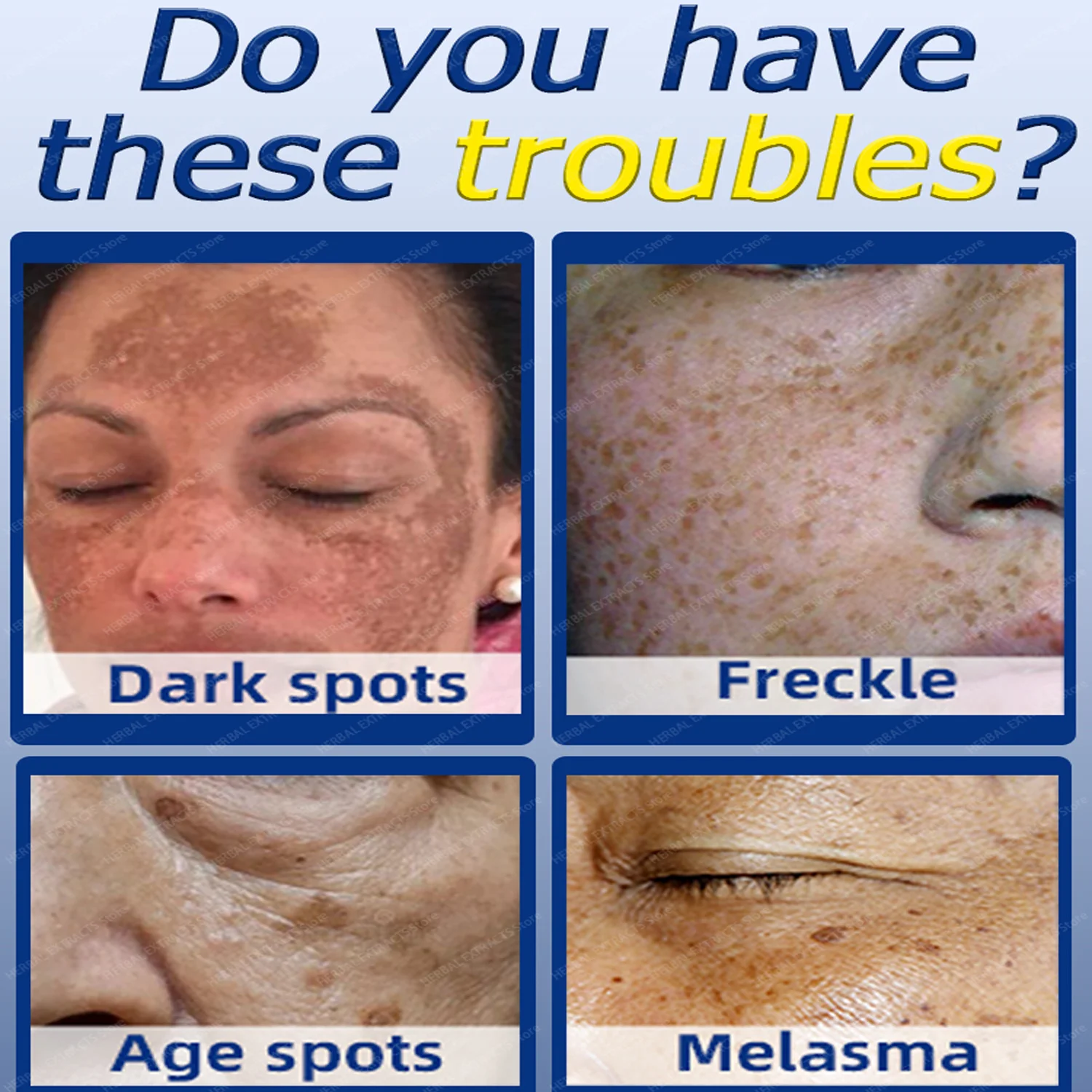 Glutathione Whitening Freckle Face Cream Remove Dark Spots Lighten Melasma Melanin Fade Acne Scars Anti-Aging_voghion.com