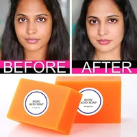 100g Kojic Acid Soap 3 Colors Option Glutathione Skin Lightening Soap Hand Made Bleaching Soap Brightening Face 1