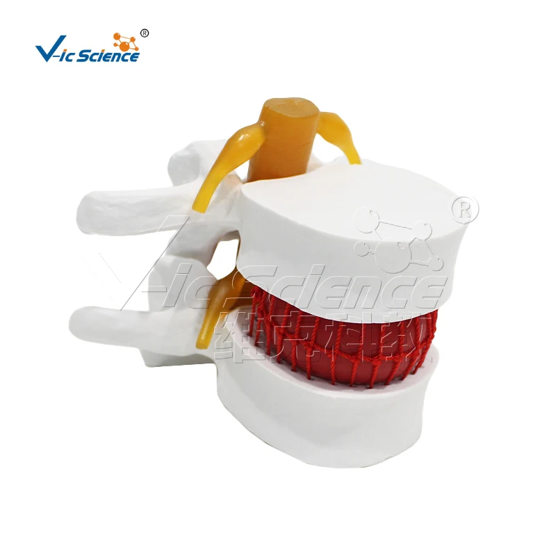 

Medical Science Lumbar Intervertebral Model Human Spine Model