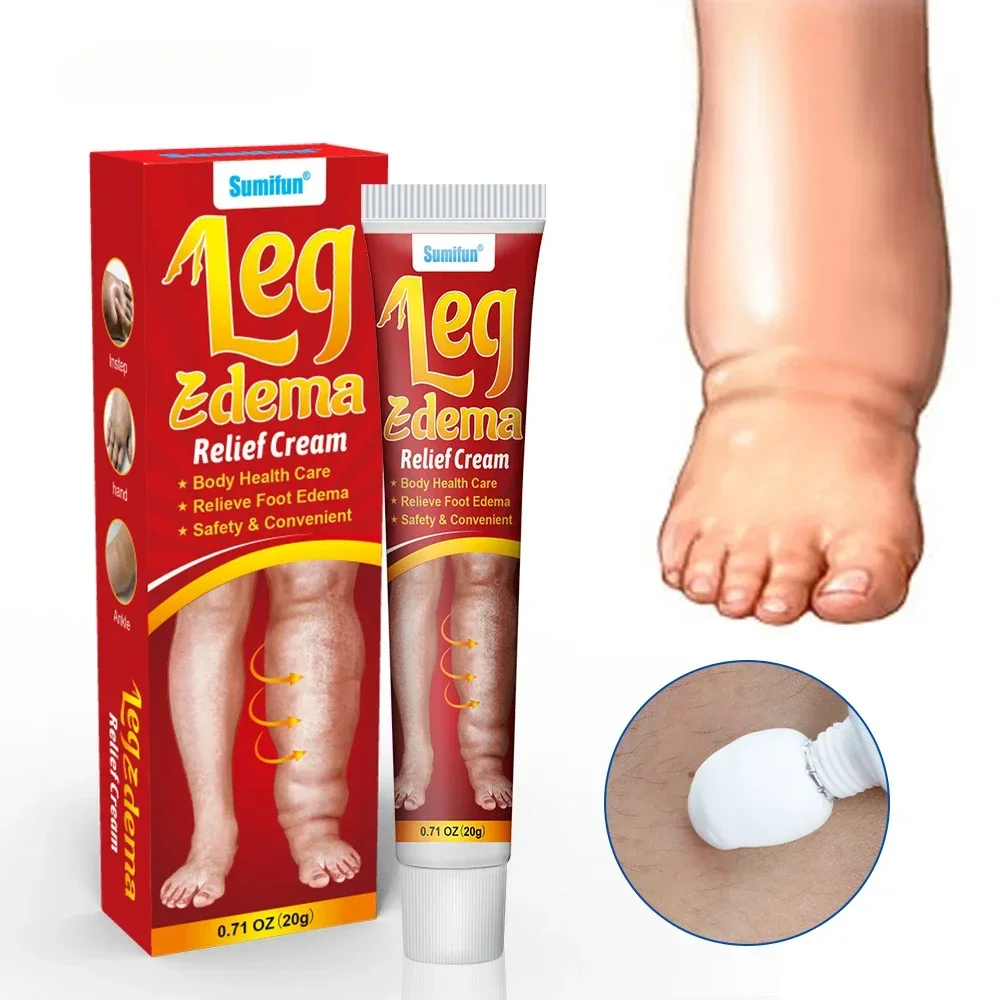 20g Leg Relief Cream For Circulation Relieve Foot Edema Massage Cream For Swollen Legs And Ankles Body Health Care personal health care,pain analgesic cream