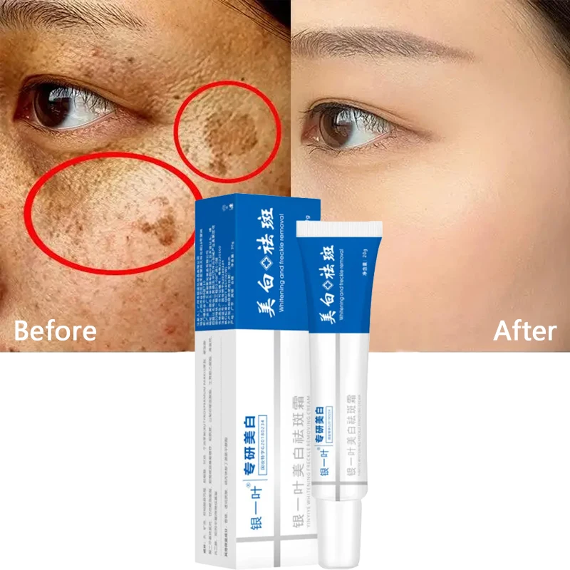 

Whitening Freckle Cream Remove Melasma Dark Spot Acne Marks Effective Improve Anti-Pigmentation Dullness Brighten Face Skin Care