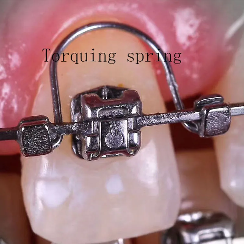 10 pz/borsa dentale ortodontico molla Torquing denti anteriori coppia molle rettangolari in acciaio inox conigliera primavera odontoiatria