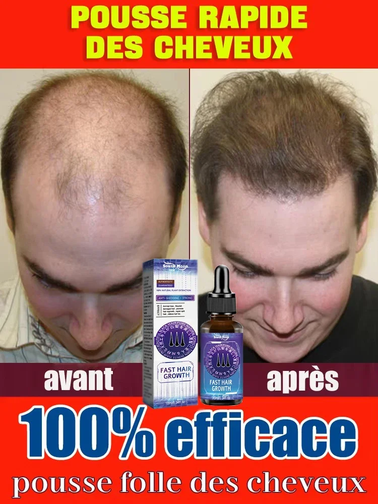 Hair Growth Essential Oil Repair Baldness and Hair