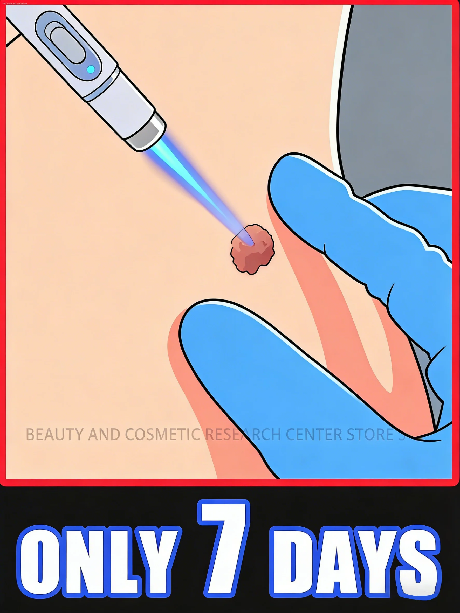 2026년 전문적이고 안전한 블루라이트는 자연스러운 분해를 유발하며, 통증이 없..