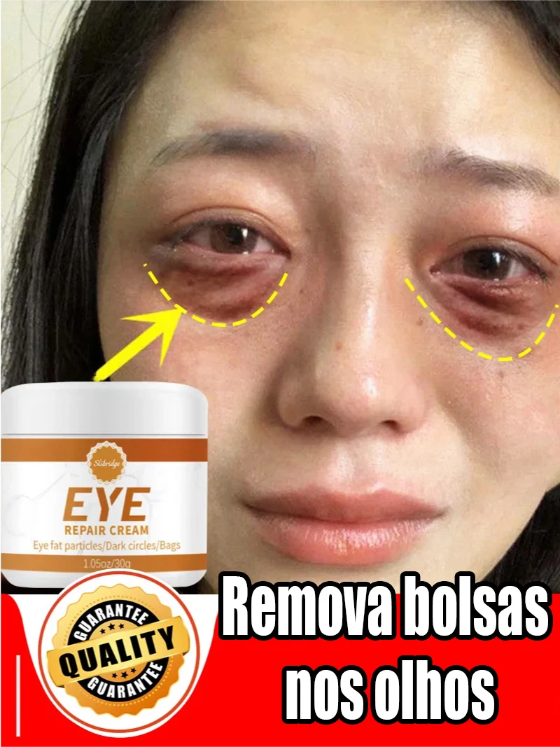 Eye cream Remove bags Puffiness away work under eyes