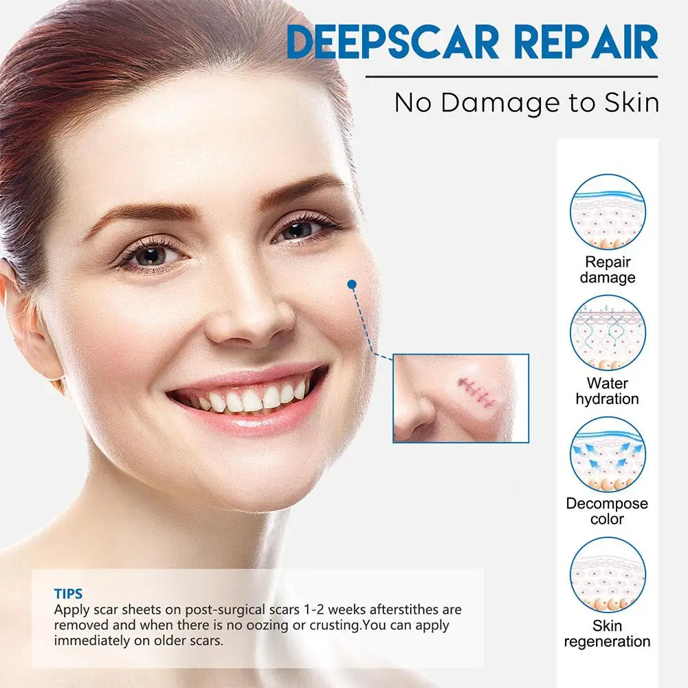 Рисунок 3 - Пластырь силиконовый для удаления рубцов