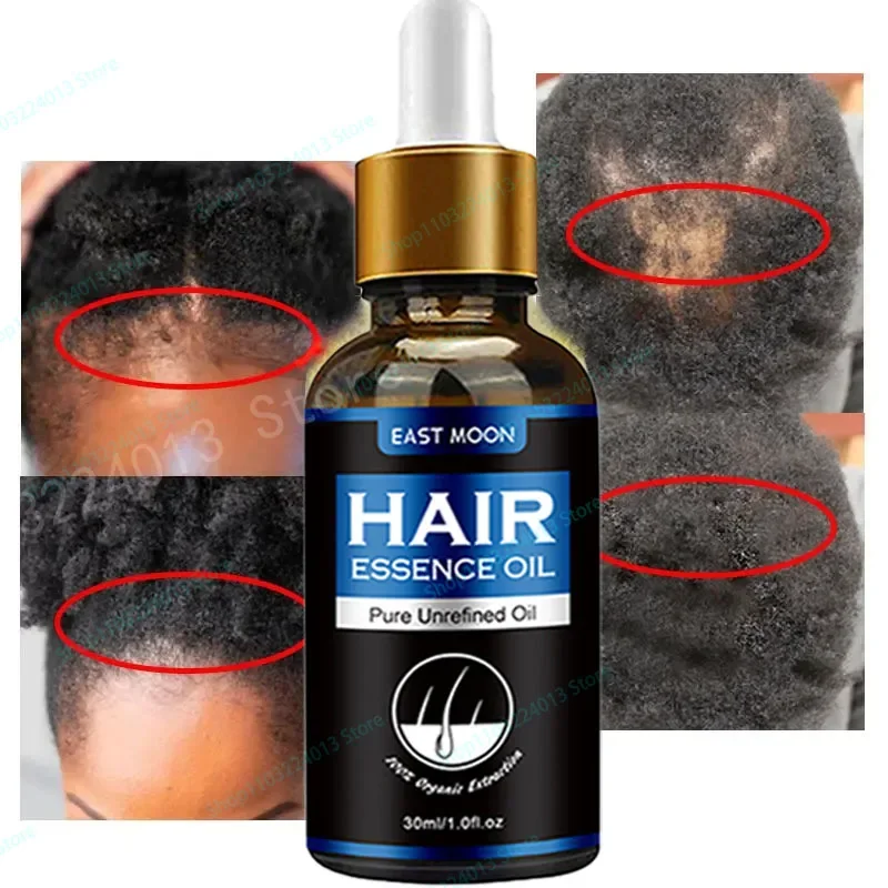 

Hair Growth Essential Oil Biotin Cold-Pressed Hair Growth Shampoo Anti-Hair Loss Conditioner