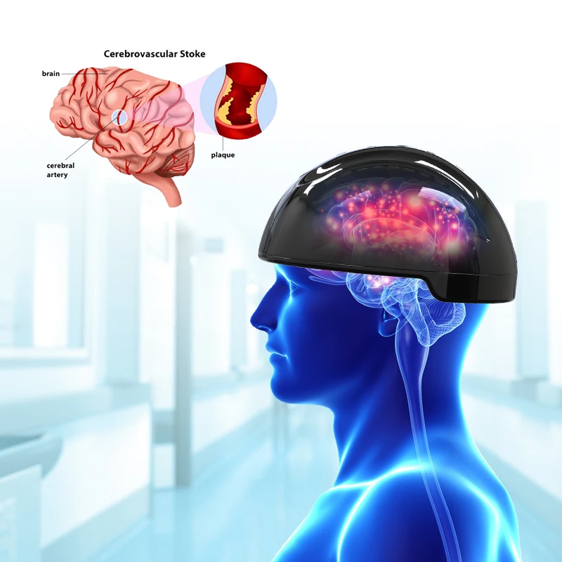 Photobiomodulation Brain Wave Helmet 810nm Infrared LED Light Therapy For Stroke Parkinsonism Disease Mental Illness Treatment 3