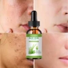 Aloe vera natural ingredients, moisturizing and nourishing the skin 1