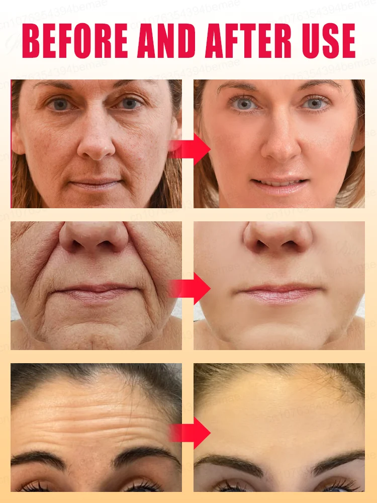 2025 Best Anti-Wrinkle Serum  - Firming Reduces Fine Lines & Deep Wrinkles - Top Rated Anti-Aging Treatment for Women & Men 3