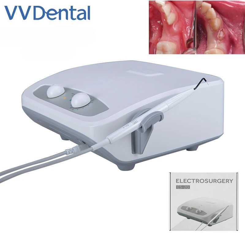 

VVDental, электро-хирургия, устройство для стоматологической электрохирургии, стоматологическая система, высокочастотный Электрический Нож для ротовой хирургии
