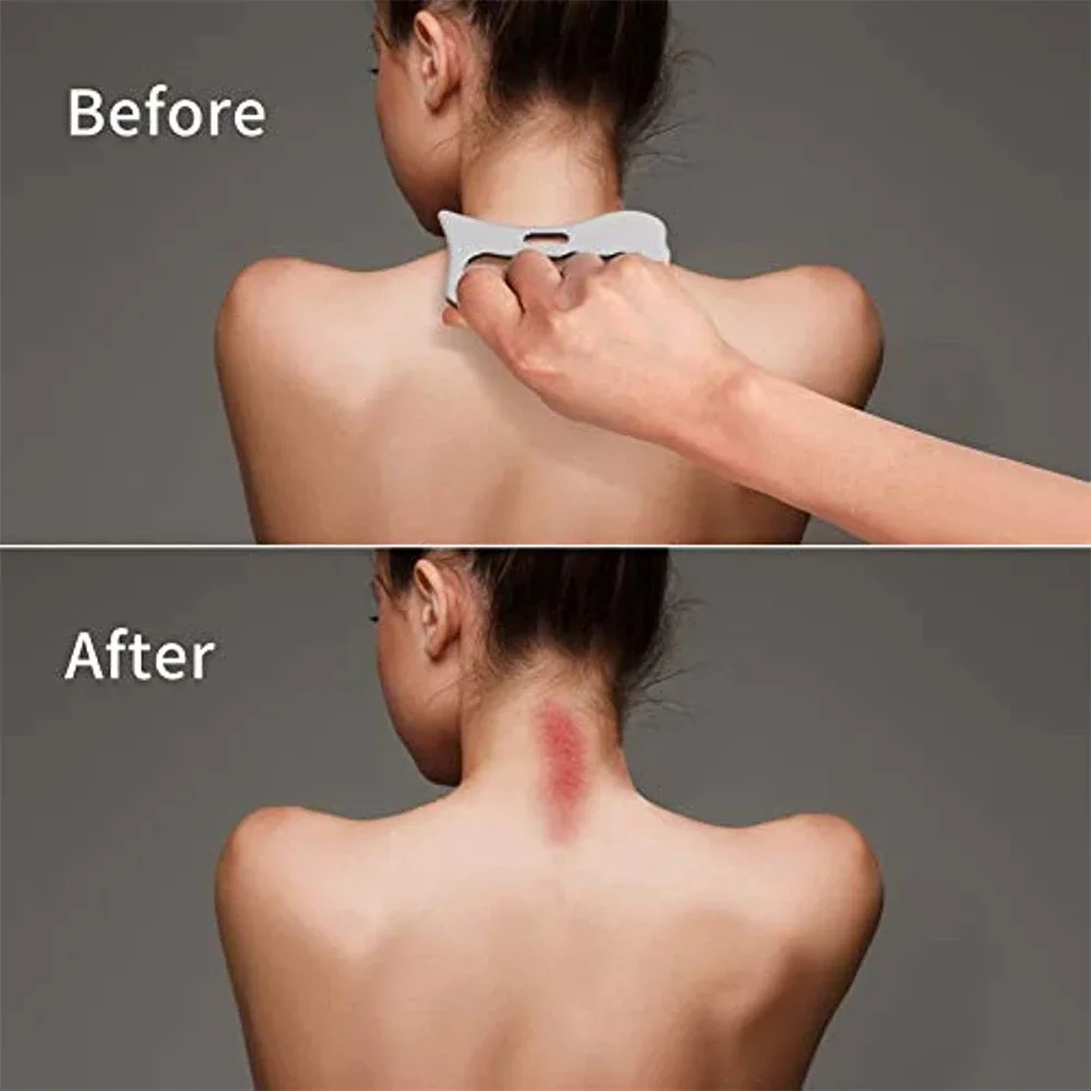 Рисунок 4 - Профессиональные массажные инструменты