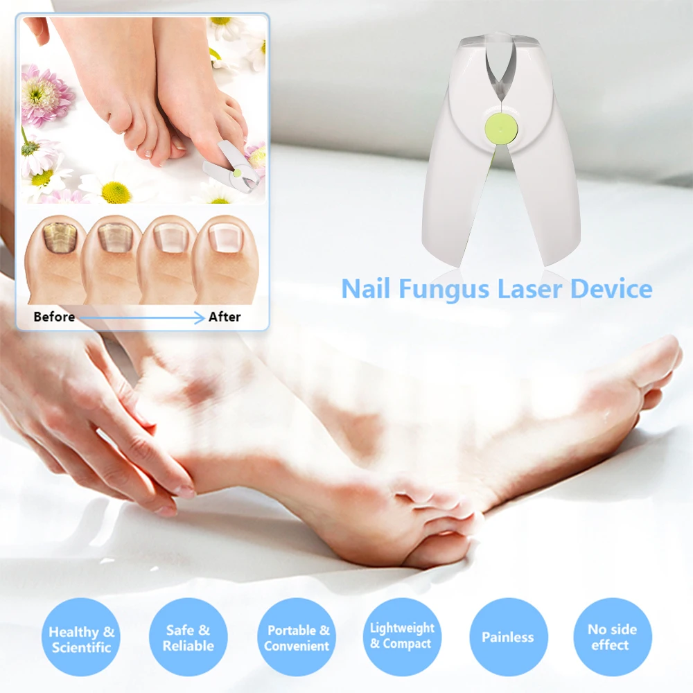 

Fungal Nail Treatment Laser Device for Nail Fungus Foot Care Fungus Nail Removal Anti Infection Paronychia Onychomycosis Care