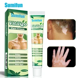 1pcs Sumifun New Upgrade Vitiligo Care Cream Leukoplakia Repair Remove White Spot Psoriasis Ointment Skin Massage Plaster Cream