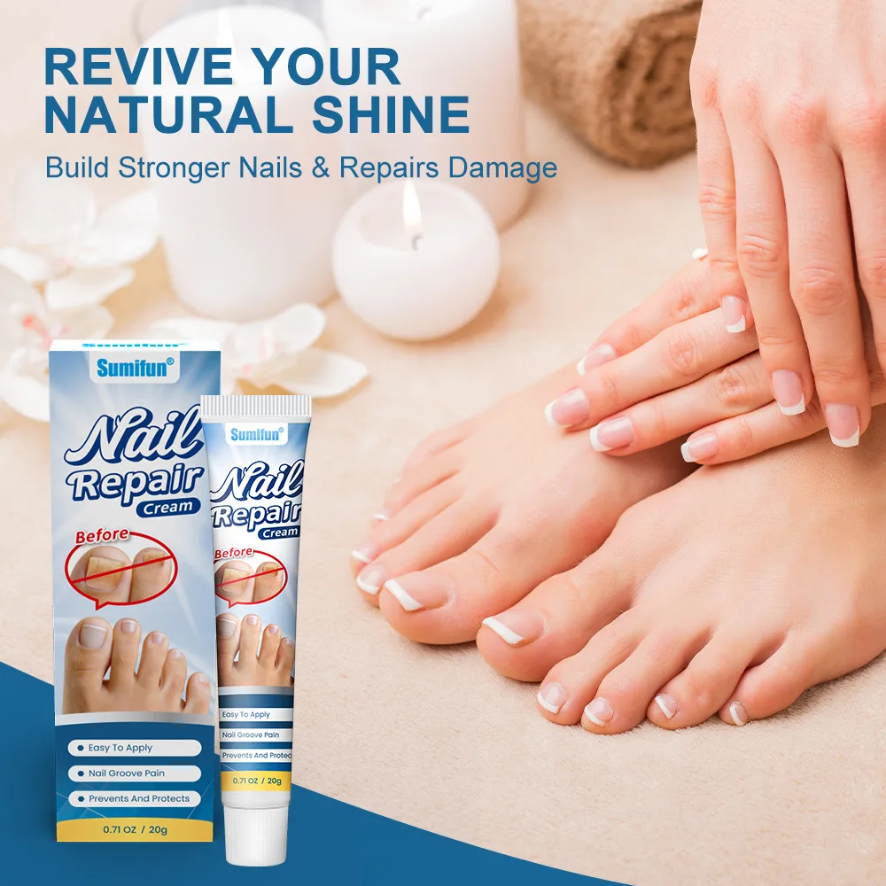 Nail Fungus Treatment Cream Foot Toe Nail Fungus Removal Serum Anti-infection Paronychia Onychomycosis Repair Gel Care U&ntilde;as