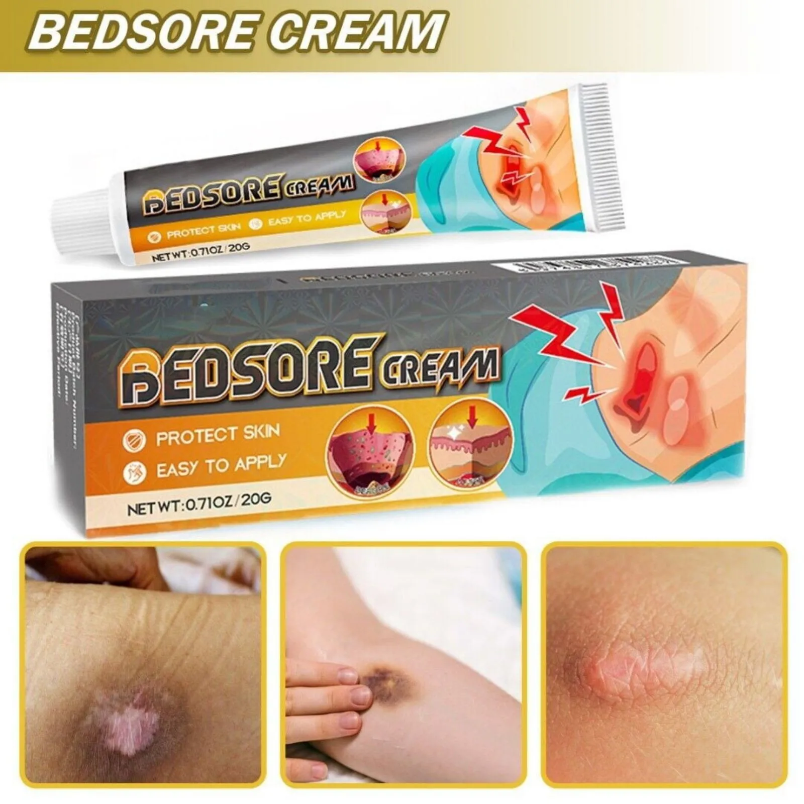 Bedsore Treatment Cream Pressure Sore Ulcer Skin Rot Necrotic Repair Ointment Bed Sore Wound Healing Decubitus Feet Care Gift