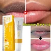 Fast Lightening Pink Mouth Lips Serum Bleaching Permanent Remove Dark Smoke Lips Lip Balm Moisturize Gloss Lipstick Lip Serum 1