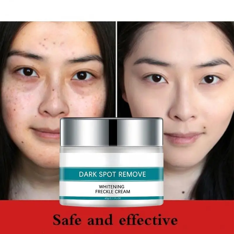 Whitening Cream  Fade Spots Blackheads Melanin Moisturizing Brightening Soft Smooth Firming Skin Care