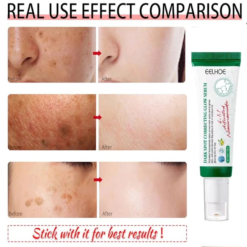Facial Serum Facial Essence Collagen Face Serum Whitening Serum Acne pit pit repair men and women Reduces Dark Spots Brightens Complexion Hydrates and Nourishes skin Reduces Melanin Production