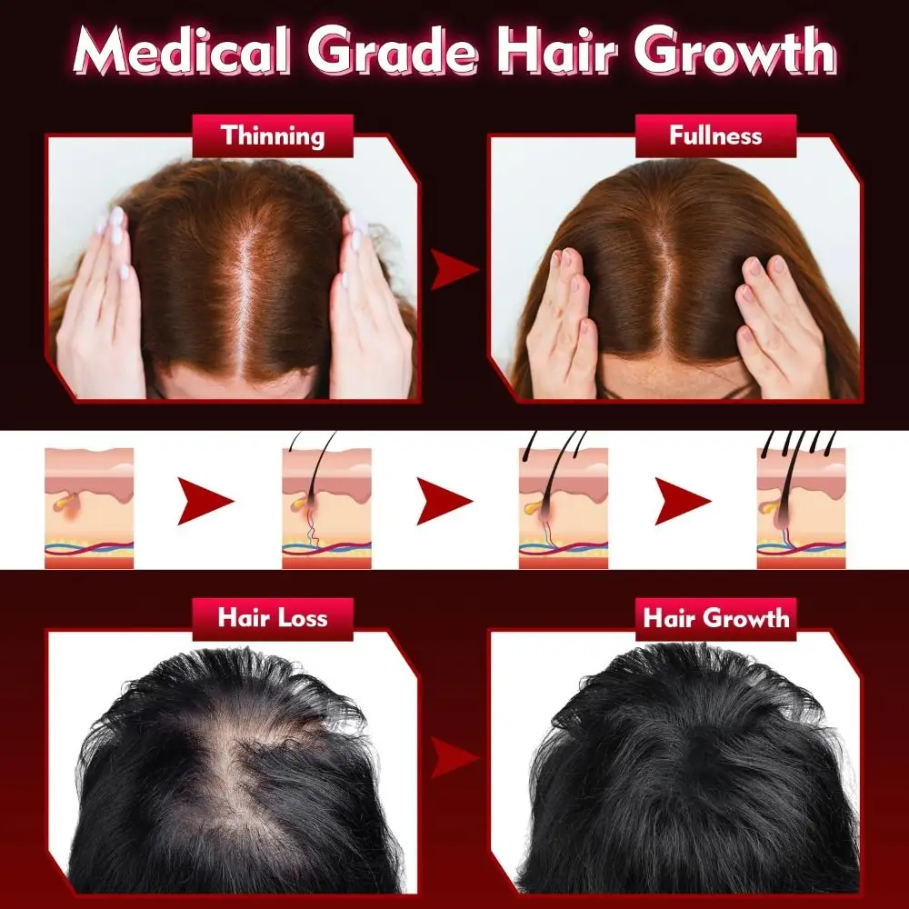 Laser Hair Growth Cap Professional Laser Red Light Therapy Device for Hair Regrowth Loss Treatments Hat for Men Women hair growth serum hair growth spray hair growth cream