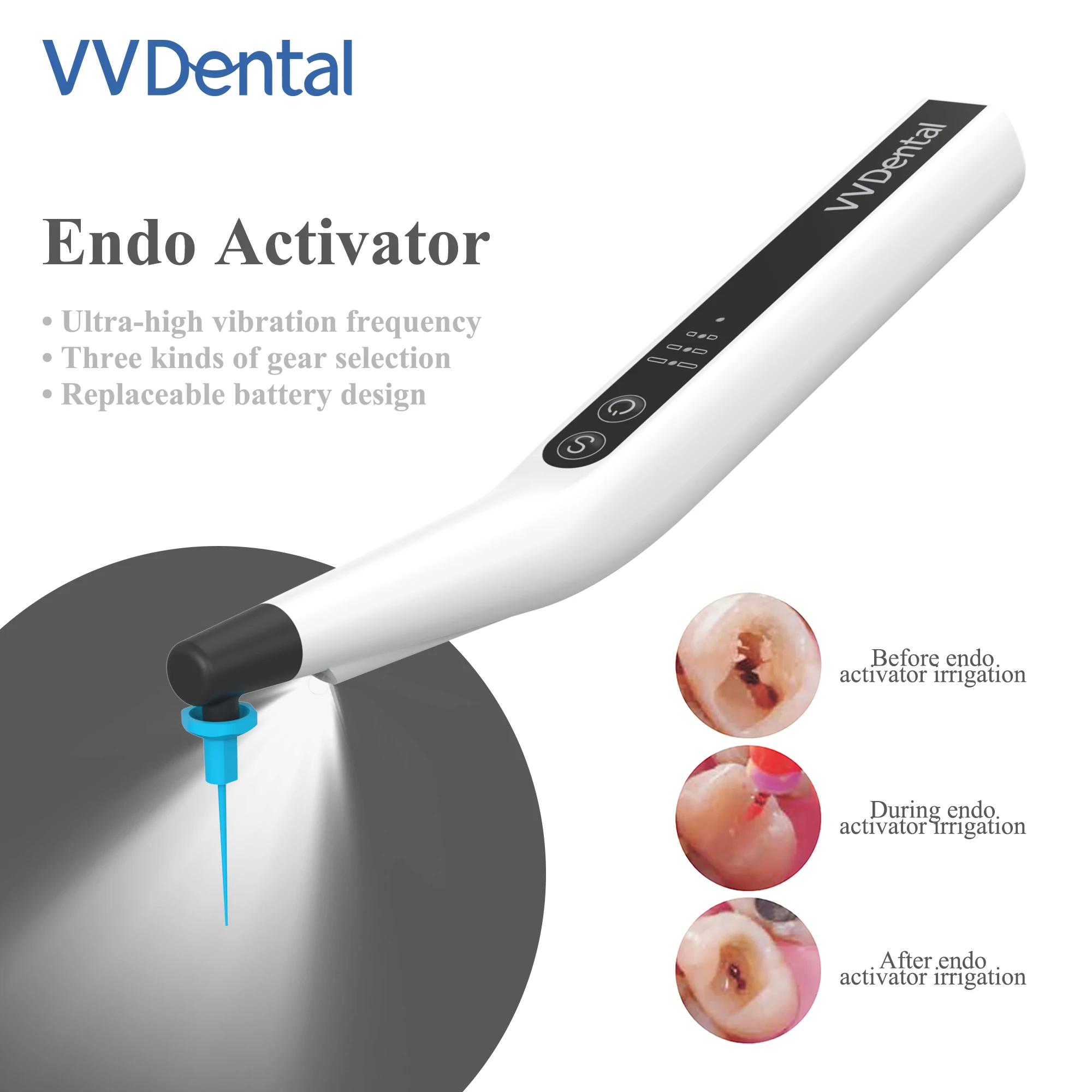 Electric Motor Dental Endoactivator With 60 Tips Sonic Irrigator With LED Light for Root Canal Endodontic Activator Motor VVDental Endomotor