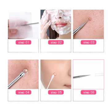 1pc Stainless Steel Blackhead Comedone Acne Blemish Extractor Remover Face Skin Care Pore Cleaner Needles Remove Tools Hot 5