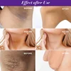 Whitening Cream Private Parts Underarm Bleaching Whiten Butt Knee Brighten Inner Thigh Intimate Parts Dark Remove Melanin Care 2