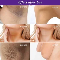 Whitening Cream Private Parts Underarm Bleaching Whiten Butt Knee Brighten Inner Thigh Intimate Parts Dark Remove Melanin Care 2