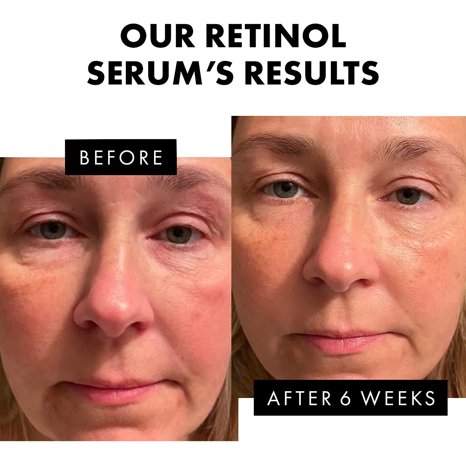 Retinol Øjeblikkelig rynkefjerner Ansigtscreme Fade Fine Linjer Anti-aldring Opstrammende Lifting Blegning Fugtgivende hudpleje_voghion.com