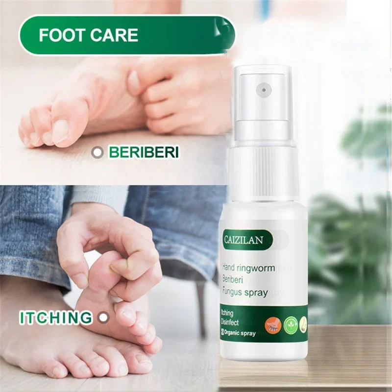 Nail Fungus Remover Pain Analgesic Cream Anti Fungal Spray Foot Fungus Cream For Cracked Heel Peeling Blister Repairing Feet