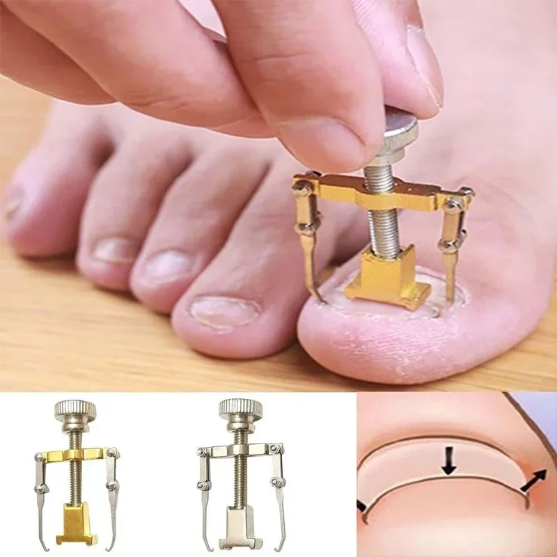 Ingrown Armor Toe Nail Correction Pedicure Fixer Straightener Clippers Recover Set Clamp Scissors Device Tool manicure pedicure kit manicure set manicure sets manicure nail clipper set nail clippers kit toe nail corrector