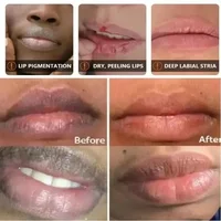 Fast Remove Dark Lip Balm Serum Lighten Melanin Lip Mask Exfoliating Fade Lip Lines Dead Skin Nourishing Repair Lip Care Makeup 3