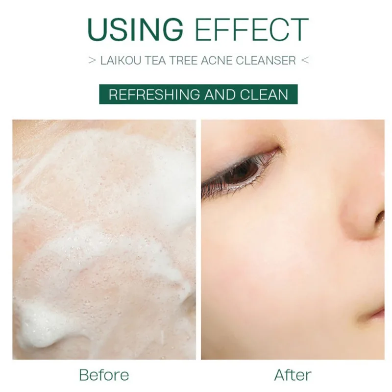 Face wash 50g Tea Tree Acne Cleanser Facial Cleansing Wash Soothe Skin Jojoba Beads Oil Control Tighten Pores Shrink Pimple Prevent No Dry