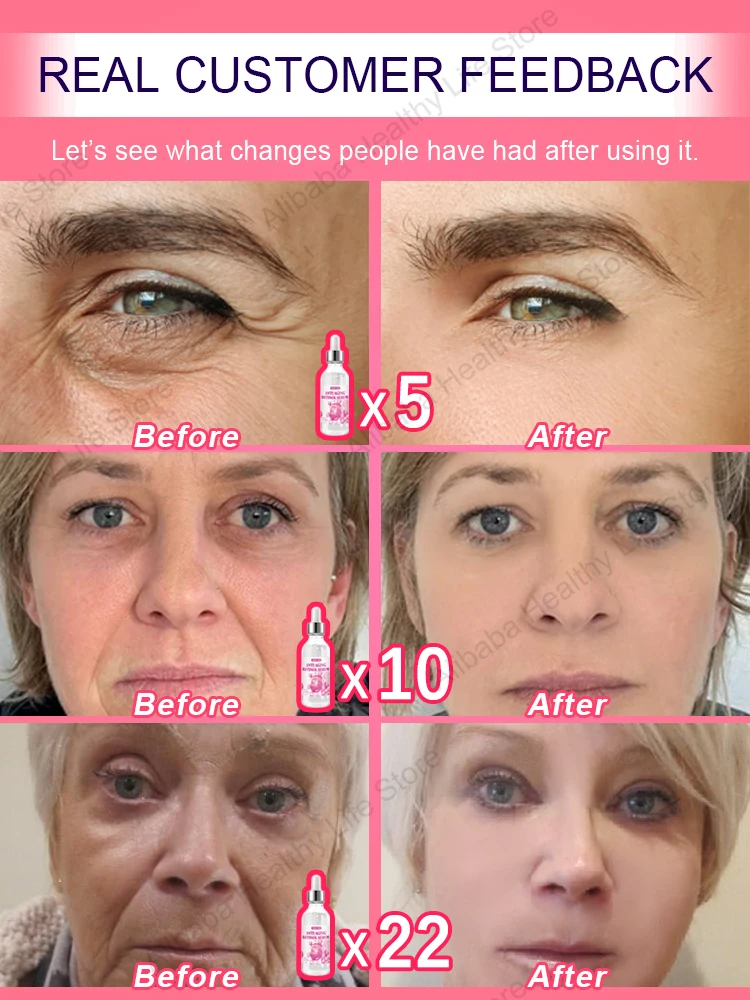 The Secret of Eternal Youth 3