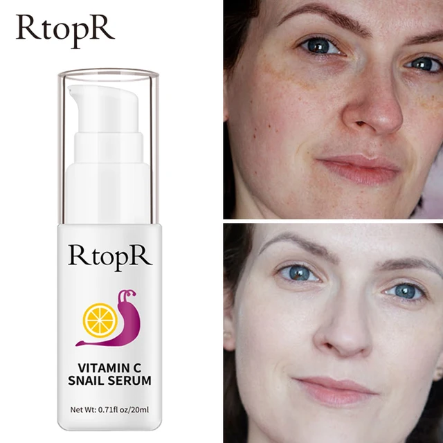 Rtoprvc Csigakivonat Fehérítő Hidratáló Tápláló Bőr Javítása Tompa Fényes Bőrápolás Egészséges Arcszérum - Image 3