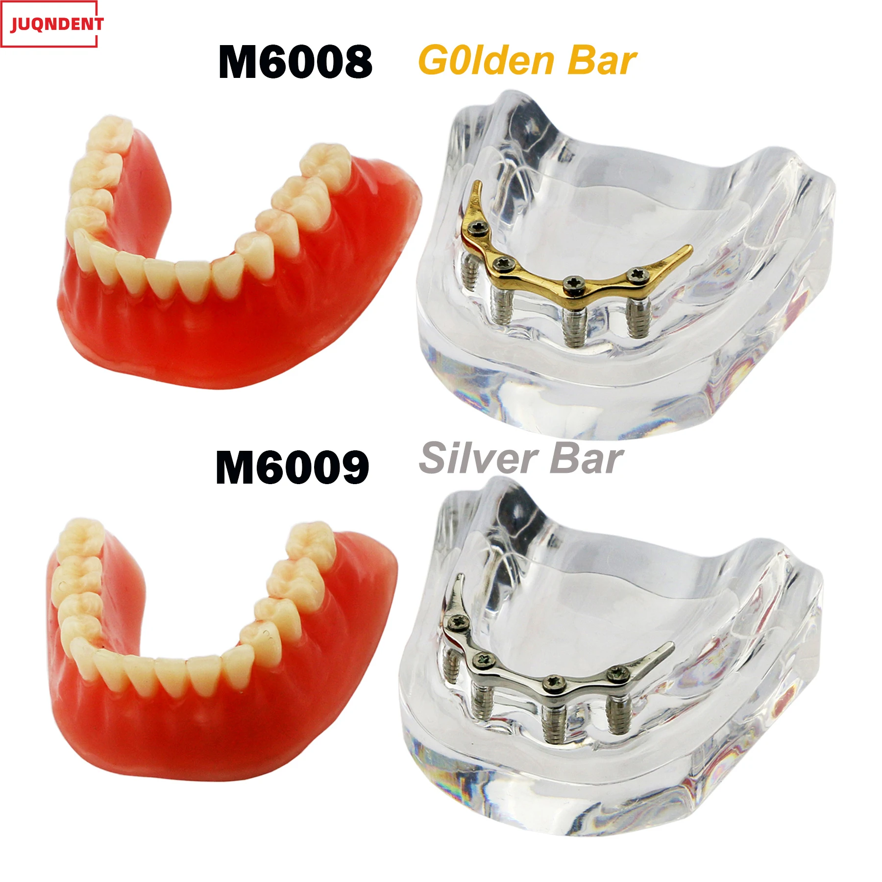 

Dental Implant Teeth Model M6008 M6009 Removable Overdenture 4 Implants Inferior Lower Restoration Treatment Demo Study